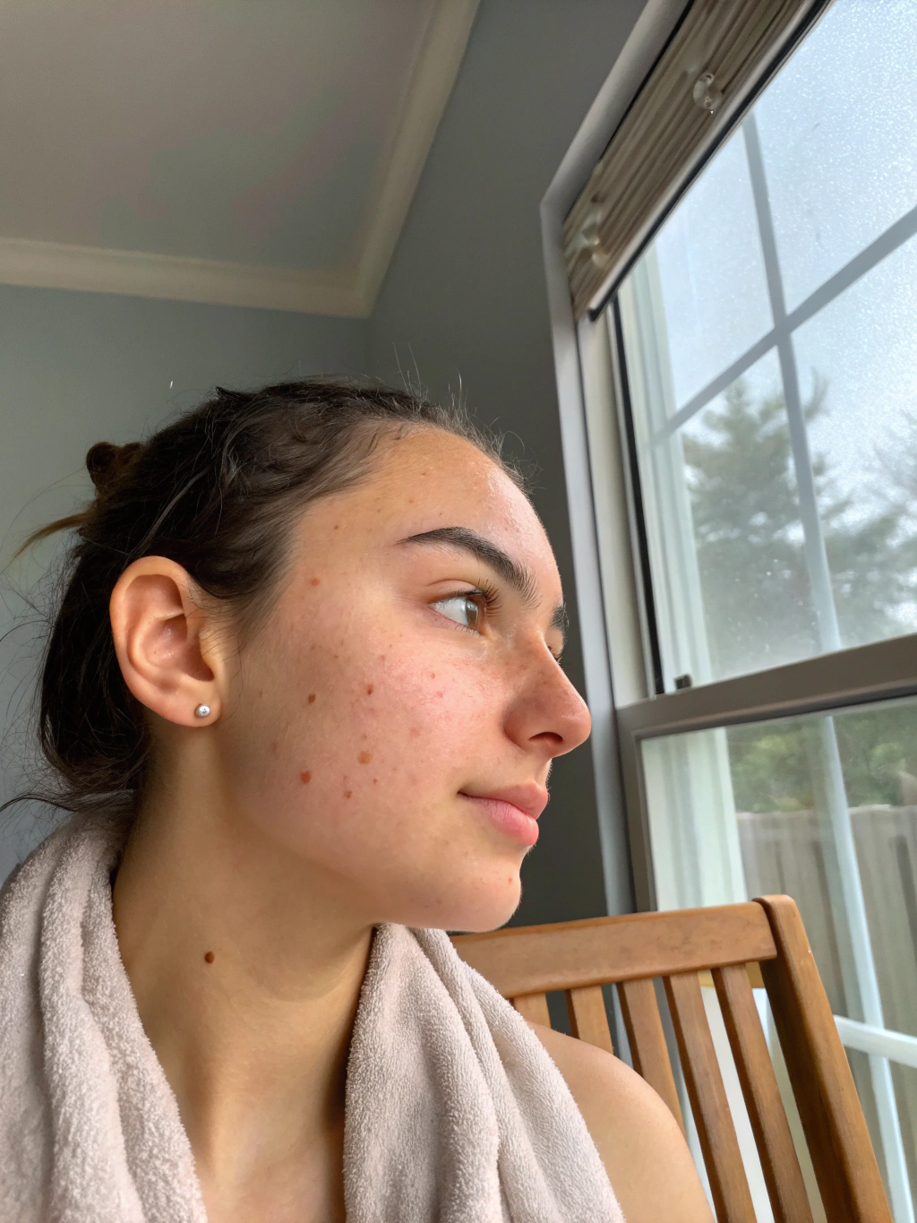 Traitement cernes - Après